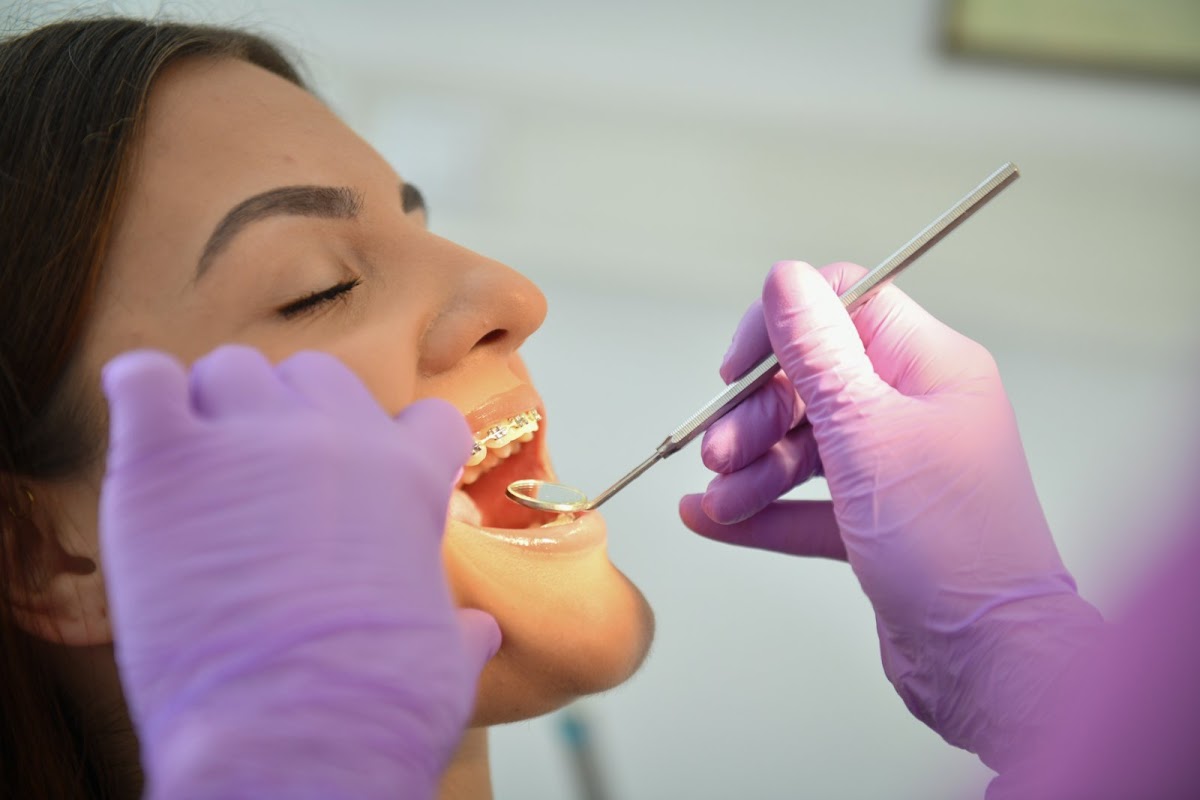 Ortodoncija - ORTODONCIJA SLAVKOVIĆ - Fiksne proteze