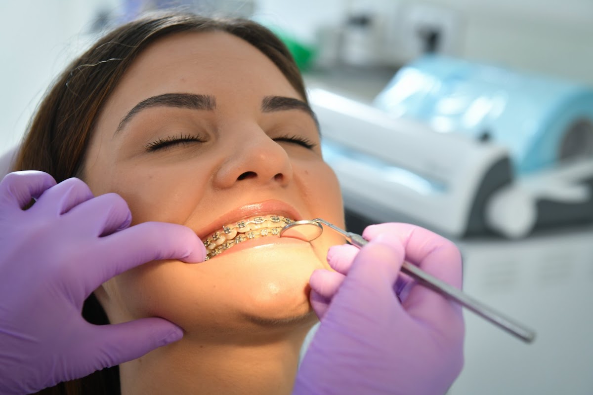 Pristupačne cene - ORTODONCIJA SLAVKOVIĆ - Fiksne proteze