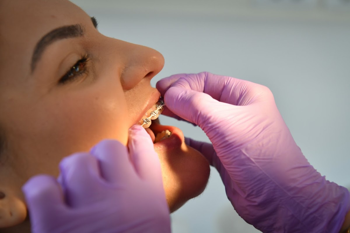 Prijatan ambijent - ORTODONCIJA SLAVKOVIĆ - Fiksne proteze